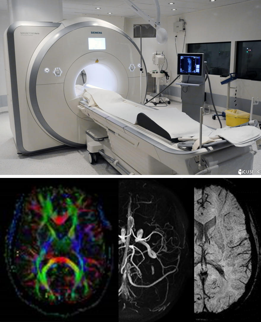 Picture of an MRI from the IRIS plaform and example of neuroimaging results