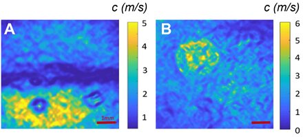 <strong>Mass concentration evaluation on ex vivo biological samples - credit: Amir Nahas, ICube</strong> <br> <em>Mass concentration evaluation on ex vivo biological samples - credit: A. Nahas, ICube</em> Rigidity pictures on ex vivo biological samples